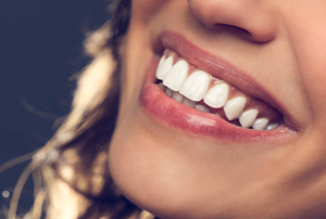 Smile