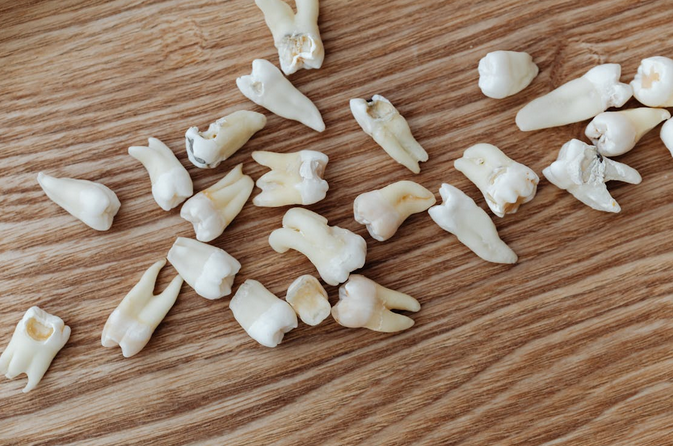 missing teeth